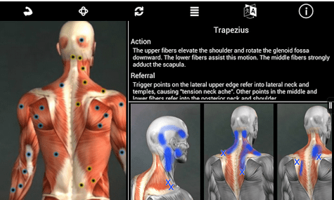 Muscle Trigger Point Anatomy v2.3.0 build 9 Paid