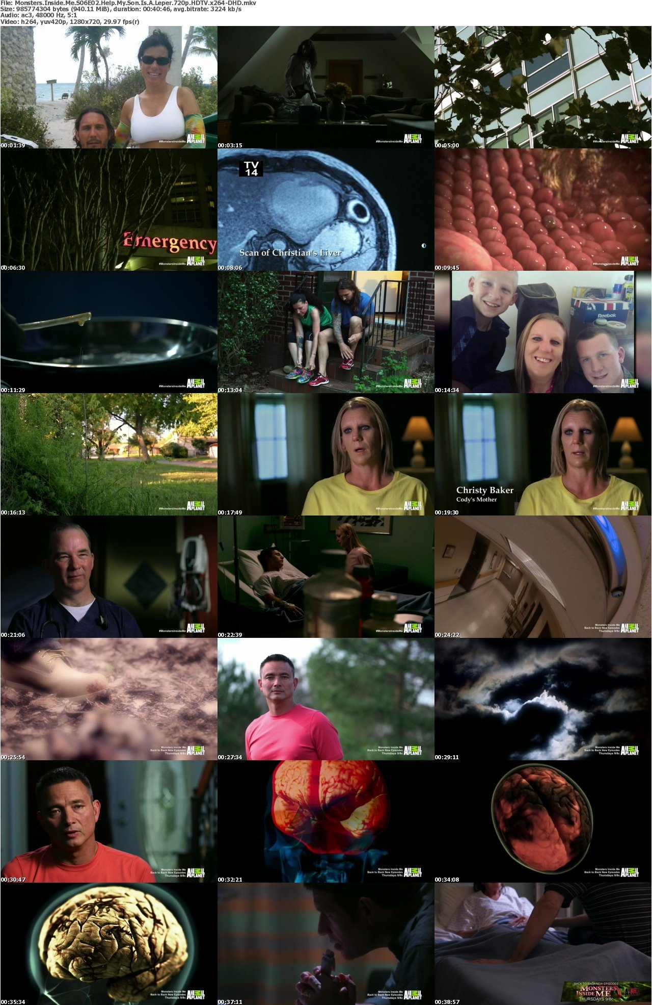 Monsters Inside Me S06E02 Help My Son Is A Leper 720p HDTV x264-DHD