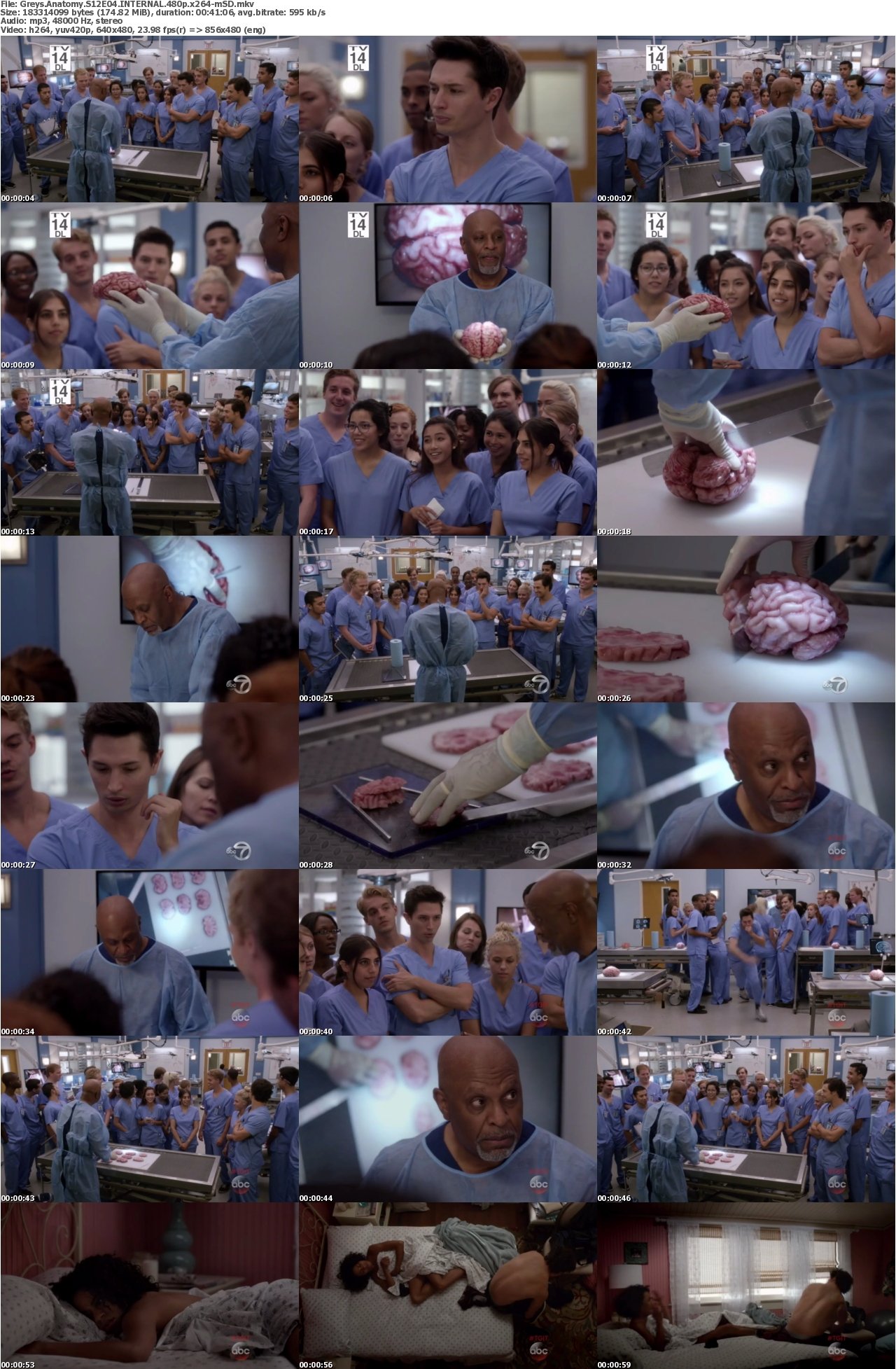 Greys Anatomy S12E04 INTERNAL 480p x264-mSD