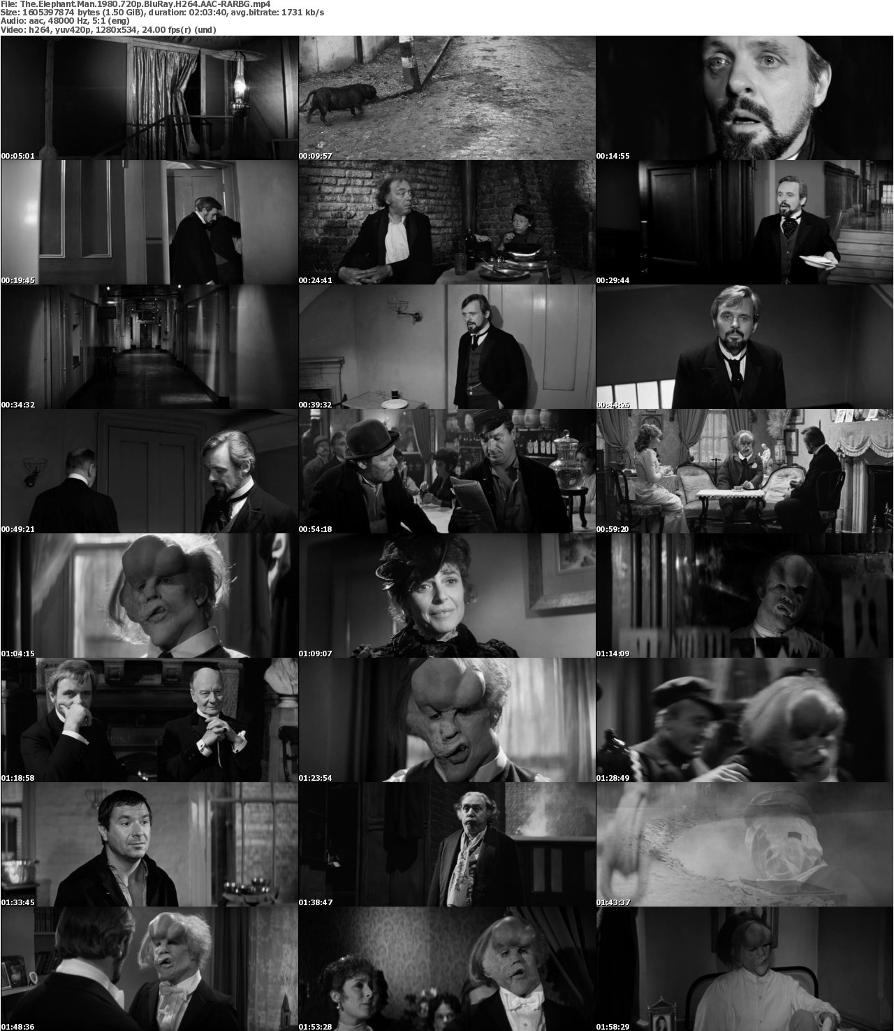 The Elephant Man 1980 720p BluRay H264 AAC-RARBG