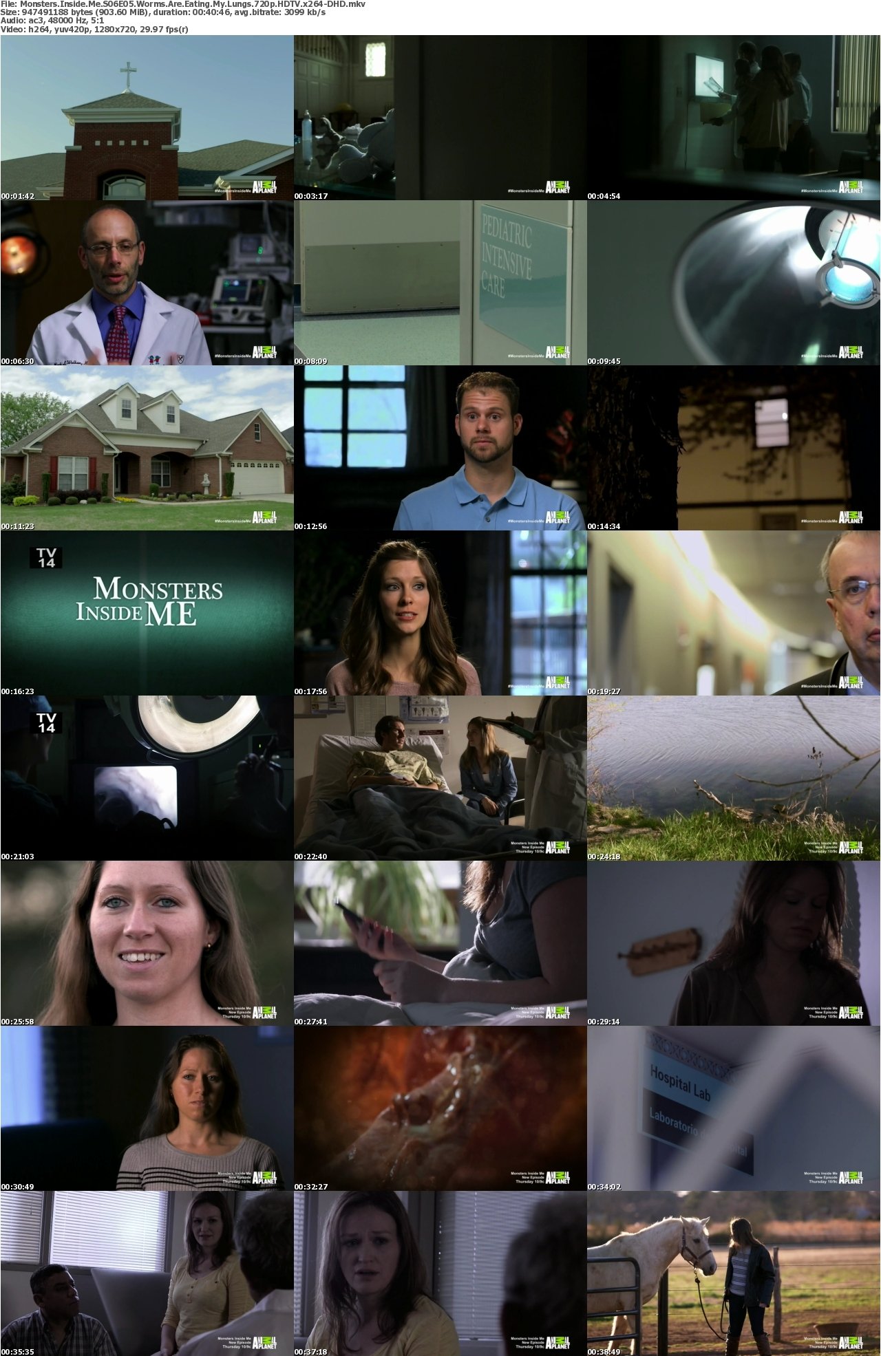 Monsters Inside Me S06E05 Worms Are Eating My Lungs 720p HDTV x264-DHD