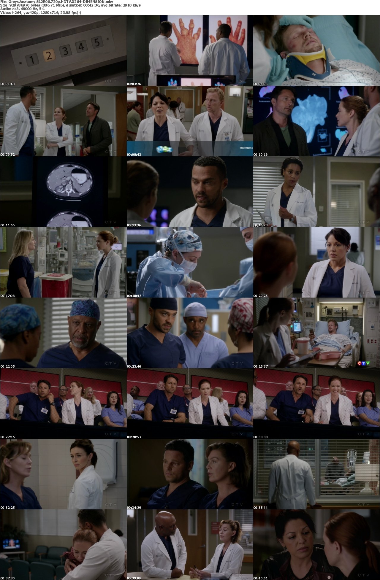 Greys Anatomy S12E06 720p HDTV X264-DIMENSION