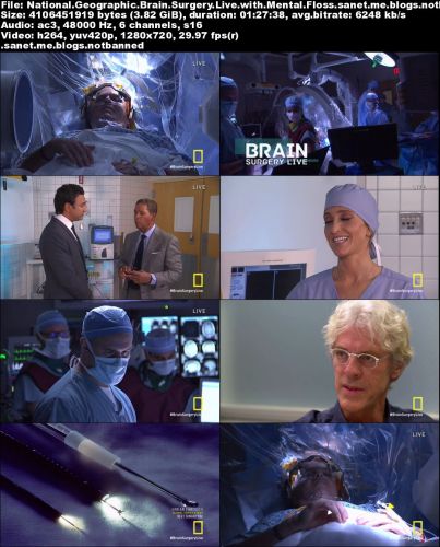 National Geographic - Brain Surgery Live With Mental Floss (2015) 720p HDTV x264-TOPKEK