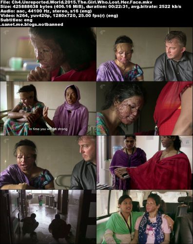 Channel 4 - Unreported World: The Girl who Lost her Face (2015) 720p HDTV x264-MVGroup