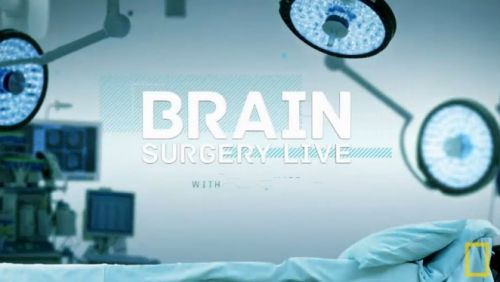 National Geographic - Brain Surgery Live With Mental Floss (2015) 720p HDTV x264-TOPKEK