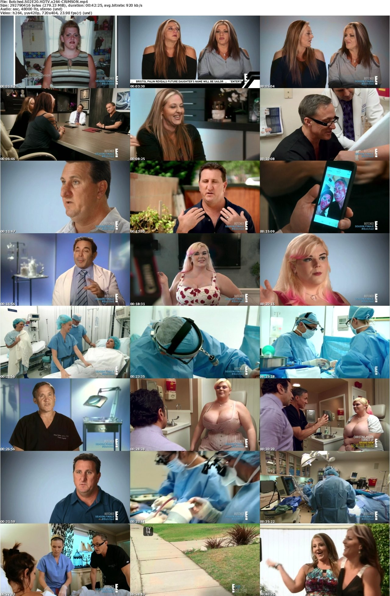 Botched S02E20 HDTV x264-CRiMSON