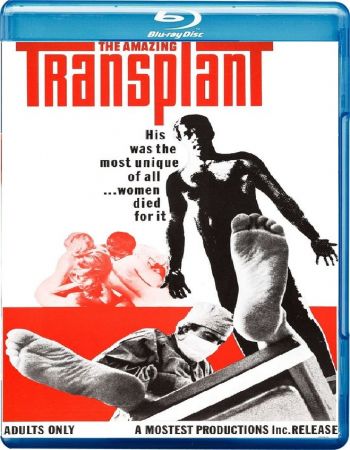 The Amazing Transplant 1970 1080p BluRay DDP2.0 x265 10bit-GalaxyRG265