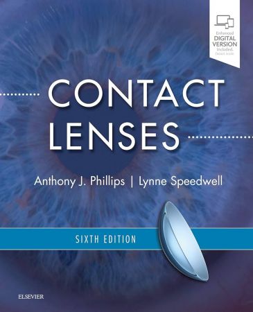 Contact Lenses 6th Edition