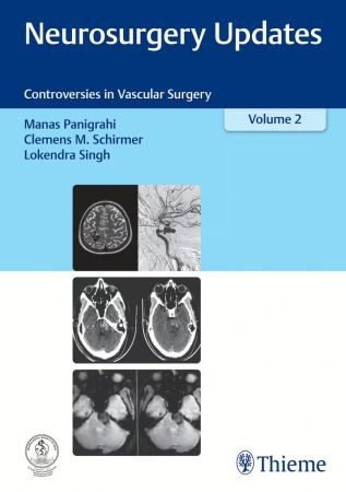 Neurosurgery Updates, Vol. 2 Controversies in Vascular Surgery