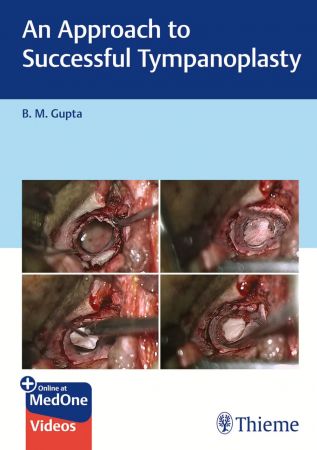 An Approach to Successful Tympanoplasty 1st Edition (True PDF Plus Videos)