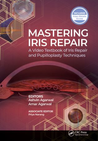 Mastering Iris Repair: A Video Textbook of Iris Repair and Pupilloplasty Techniques 1st Edition