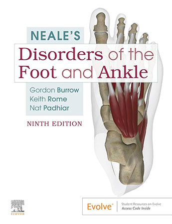 Neale's Disorders of the Foot and Ankle, 9th Edition