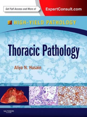 Thoracic Pathology: A Volume in the High Yield Pathology Series 1st Edition