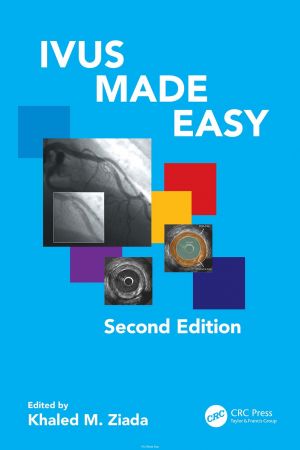 IVUS Made Easy