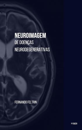Neuroimagem de Doencas Neurodegenerativas (Portuguese Edition)