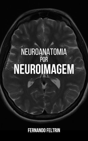Neuroanatomia por Neuroimagem (Portuguese Edition)