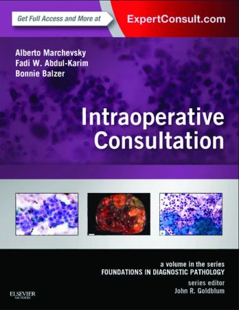 Intraoperative Consultation: A Volume in the Series: Foundations in Diagnostic Pathology 1st Edition