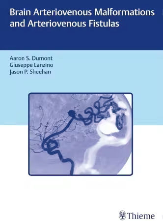Brain Arteriovenous Malformations and Arteriovenous Fistulas Illustrated Edition (True PDF Plus Videos)
