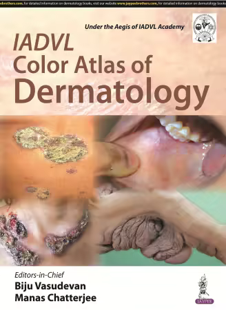 IADVL Color Atlas of Dermatology 1st Edition