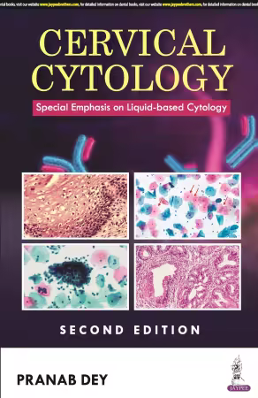 Cervical Cytology: Special Emphasis on Liquid-based Cytology 2nd Edition