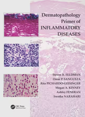 Dermatopathology Primer of Inflammatory Diseases 1st Edition