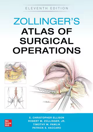 Zollinger's Atlas of Surgical Operations, 11th Edition (HQ PDF)