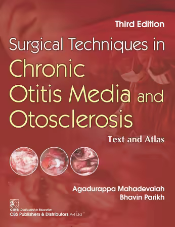 Surgical Techniques in Chronic Otitis Media and Otosclerosis 3rd Edition