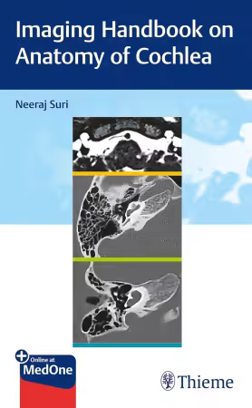 Imaging Handbook on Anatomy of Cochlea 1st Edition