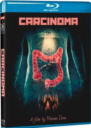 Carcinoma 2014 1080p BluRay x264 AAC 5.1-WORLD