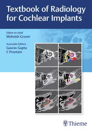 Textbook of Radiology for Cochlear Implants 1st Edition