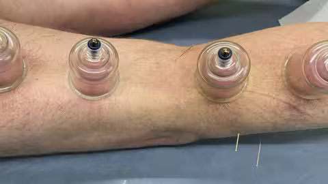 Professional Dry Cupping Therapy Course