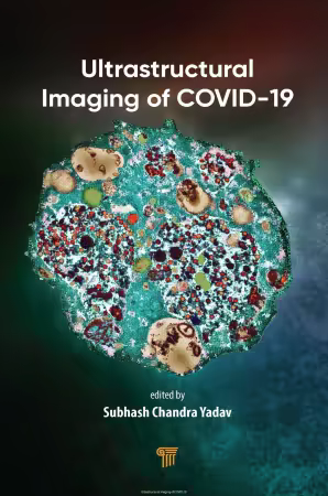 Ultrastructural Imaging of COVID-19