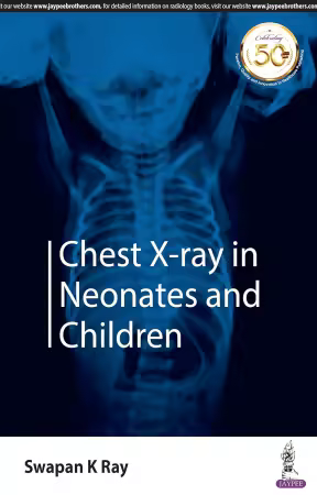 Chest X-Ray in Neonates and Children 1st Edition