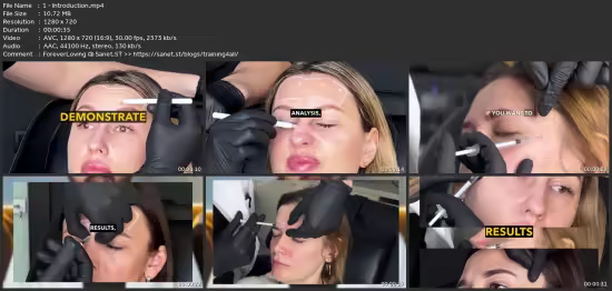 Botulinum Toxin Injection Training For Doctors – Upper Face