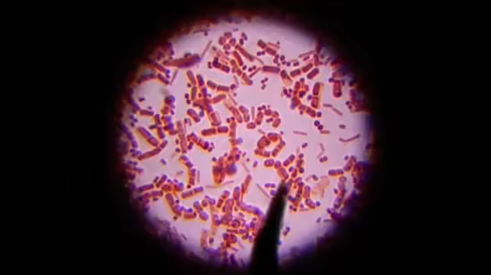 Healing Your Microbiome: Probiotics and Microbes