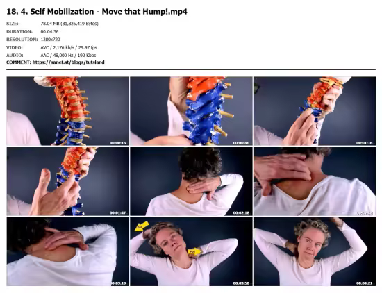 Neck Hump | Get Rid of the Fat at the Top of Your Back