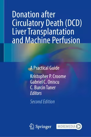 Donation after Circulatory Death (DCD) Liver Transplantation and Machine Perfusion