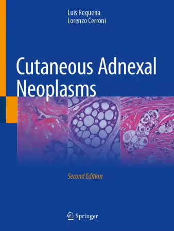 Cutaneous Adnexal Neoplasms Second Edition