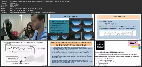 Master Adult Electroencephalography (Eeg) Insights