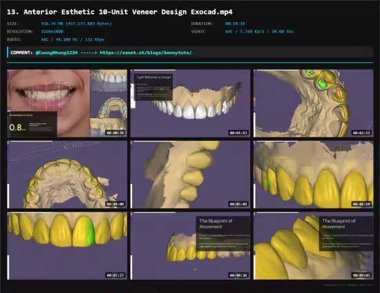 Anterior Design Principles &amp; Digital Smile Design (DSD)