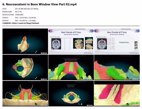 Clinical Head CT: Neuroanatomy &amp; Disorders