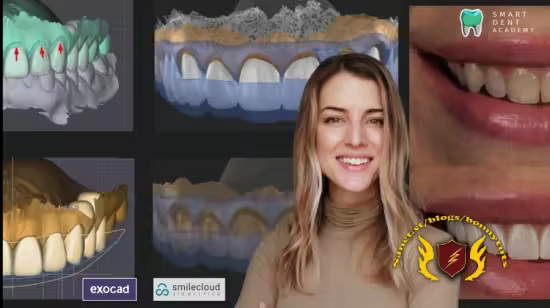 Anterior Design Principles &amp; Digital Smile Design (DSD)