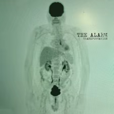 The Alarm - Transformation (2026)