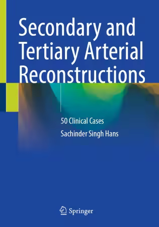 Secondary and Tertiary Arterial Reconstructions
