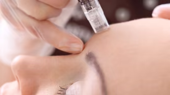 Clinical Microneedling &amp; CIT Masterclass