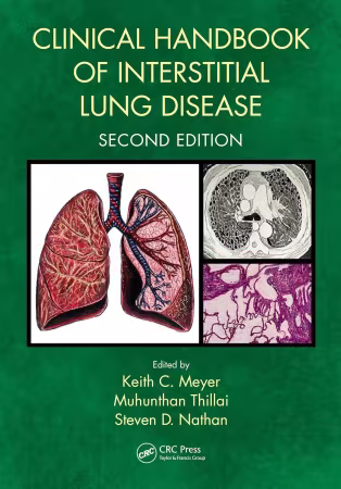 Clinical Handbook of Interstitial Lung Disease, 2nd Edition