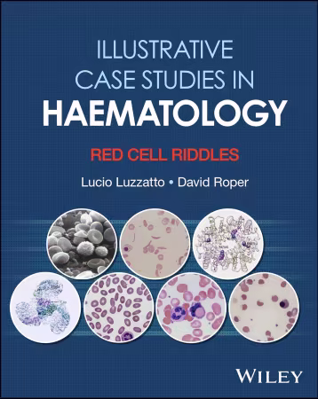 Illustrative Case Studies in Haematology: Red Cell Riddles