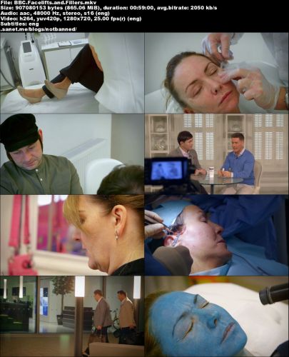 BBC - Facelifts and Fillers (2016) 720p HDTV x264-MVGroup
