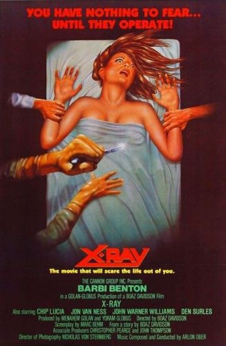 X-Ray 1981 1080p BluRay x264-SPLiTSViLLE