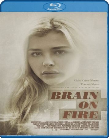 the brain on fire book